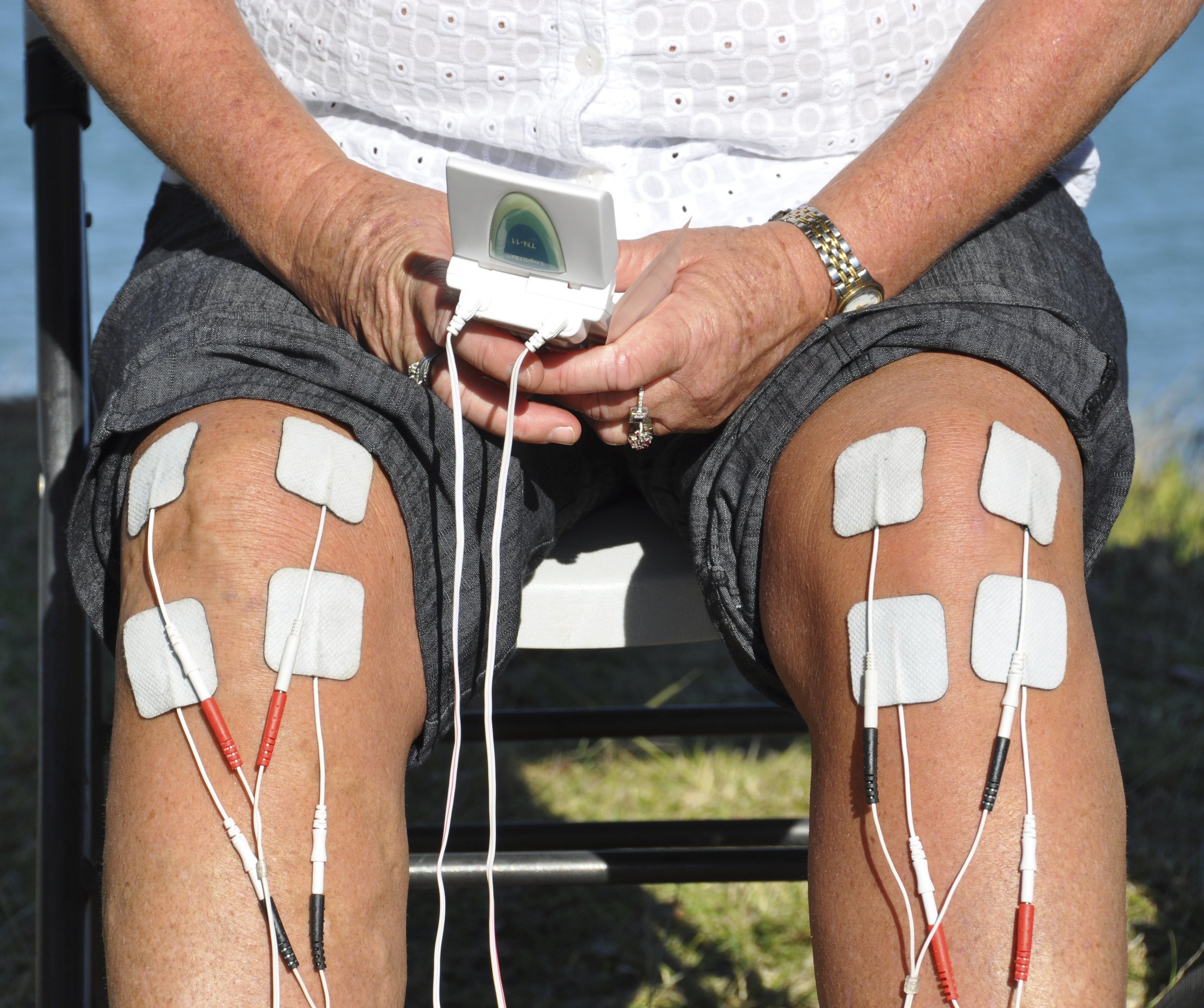 TNS… - TNS (Transcutaneous Neuromuscular Stimulation), is used for neurogenic pain relief and helps reduce the necessity of using pharmaceutical pain relief.Learn More…